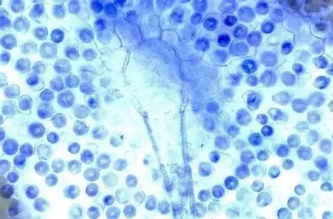 key-points-for-evaluating-cryopreservation.jpg key-points-for-evaluating-cryopreservation.jpg